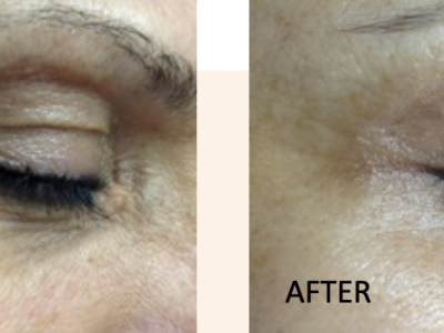 Screenshot 2025-03-04 at 5.35.11 PM